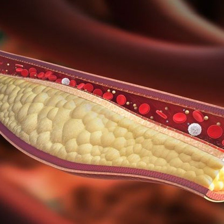 Gambar: Makanan Tinggi Kolesterol yang Perlu Diketahui